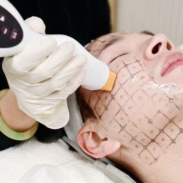 Thermage®