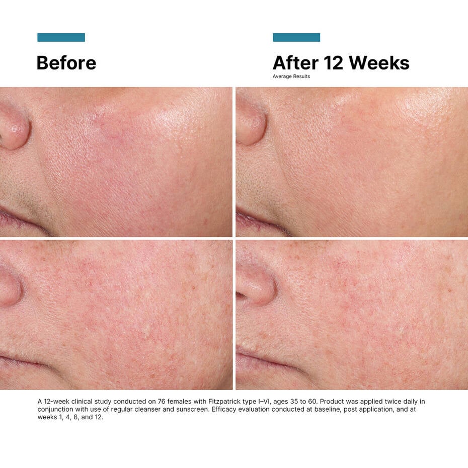Advanced RGN-6｜50mL