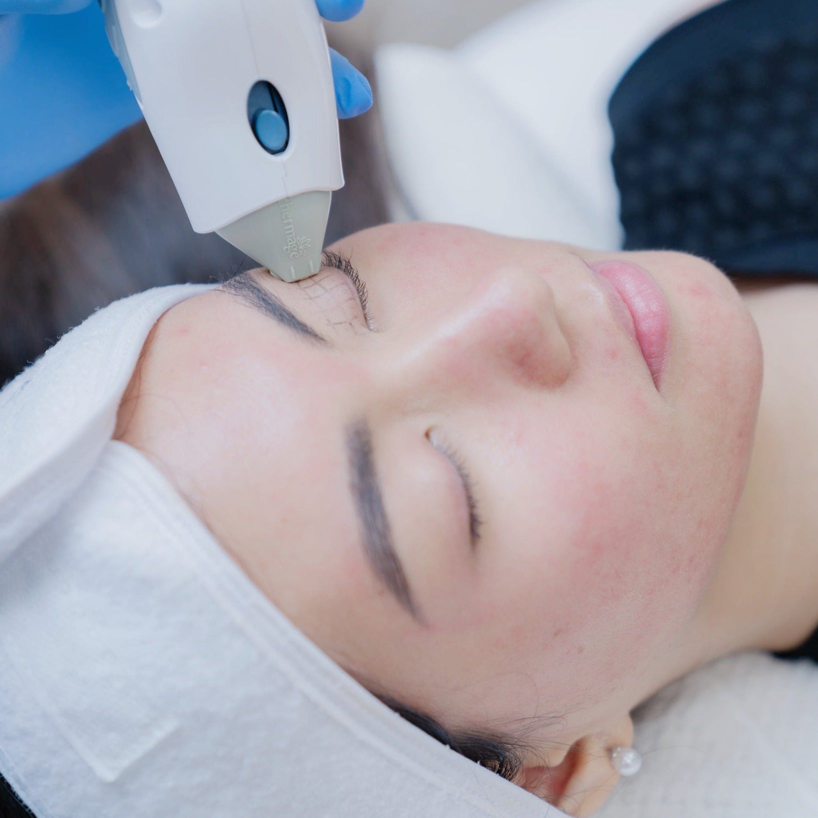 Thermage®