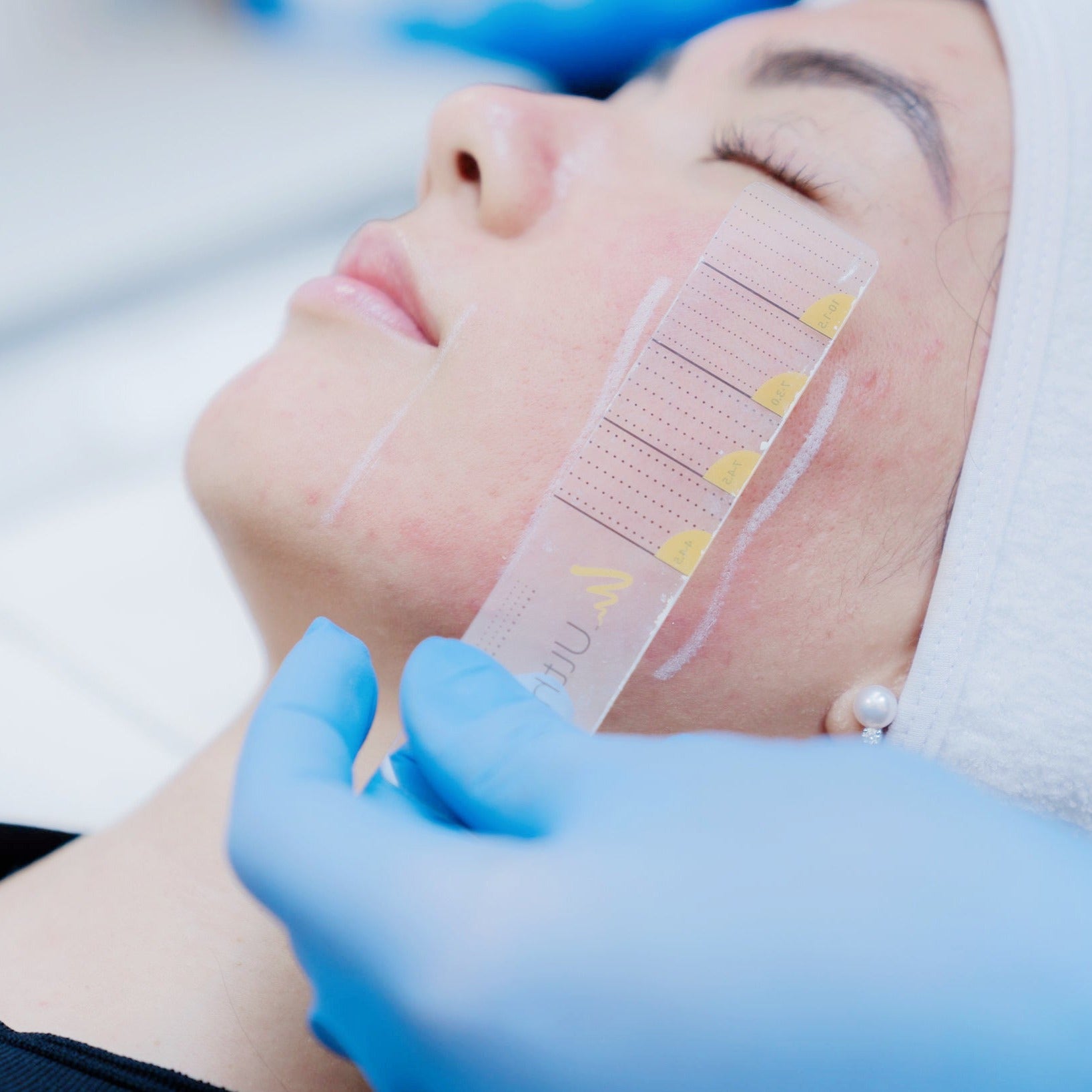 Ultherapy®