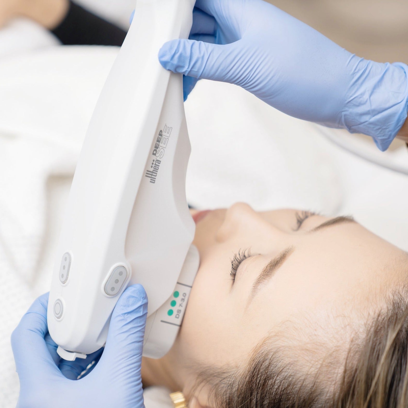 Ultherapy®